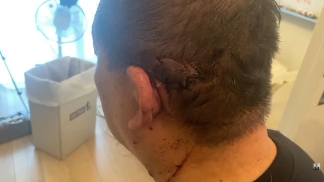 立花孝志 襲撃 ナタ 閃光手榴弾 グレネード 犯人 自作自演 傷 NHKから国民を守る党に関連した画像-03