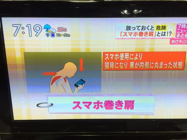 スマホ巻き肩 巻き肩 肩こり 頭痛に関連した画像-04