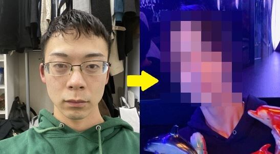 チー牛 陰キャ 1000万 整形 骨延長 手術 イケメン ホスト 歌舞伎町 髪 輪郭 顎 に関連した画像-01