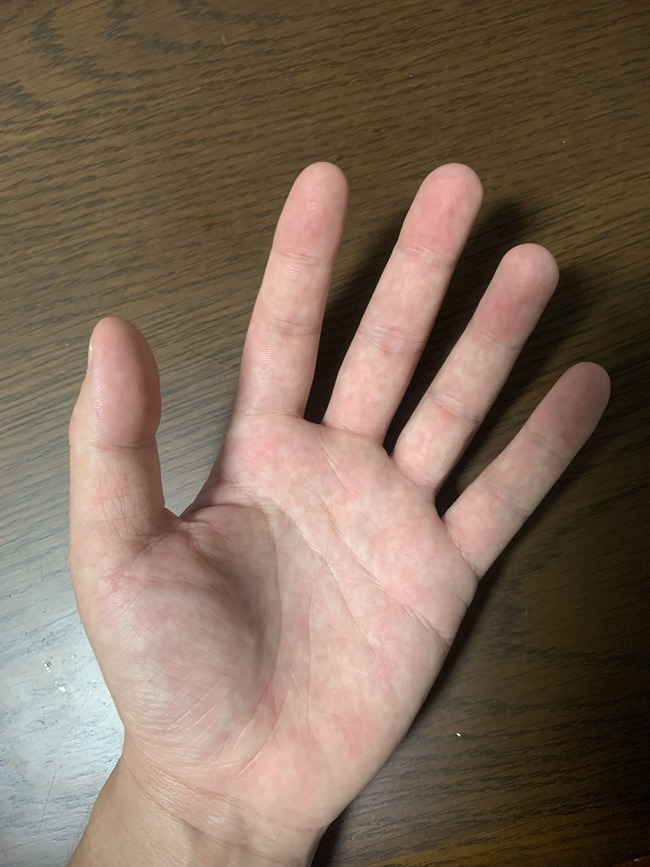 SNS 美白 自撮り 信用しない 理由 背景に関連した画像-08