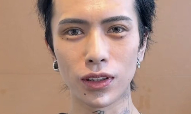 歌舞伎町 ホスト 額縮小 血行不良 ハゲに関連した画像-01