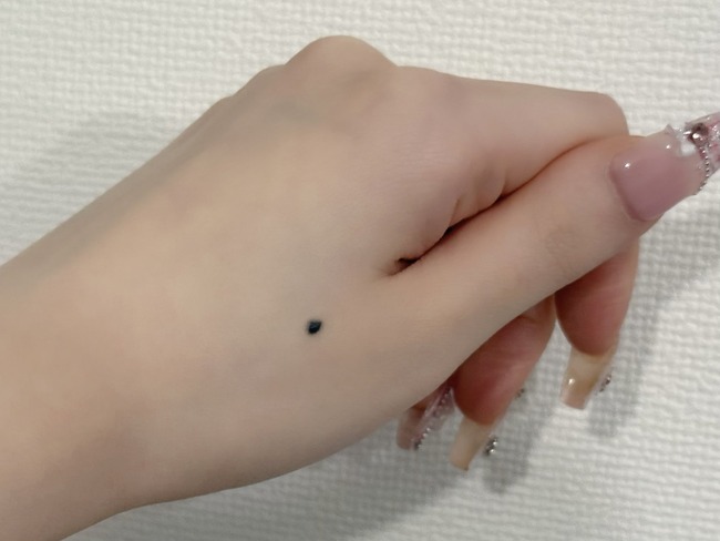 鉛筆 手 皮膚 芯 傷 ほくろに関連した画像-02