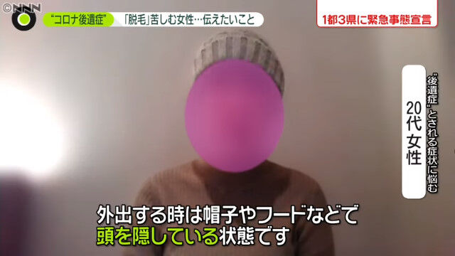 新型コロナ 女子大学院生 後遺症 脱毛 ハゲに関連した画像-07