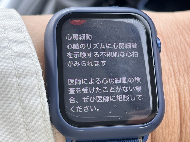 ���åץ륦���å����Ρ����ѡ���¡����ư���±��˴�Ϣ��������-02
