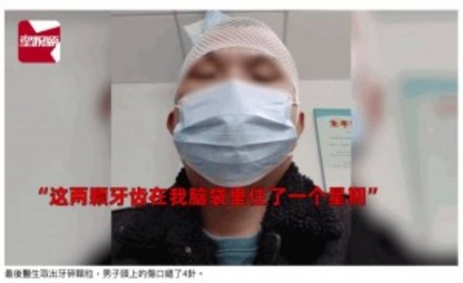 中国 男性 バスケ 相手選手 衝突 頭 異臭 病院 治療 歯 発見に関連した画像-01