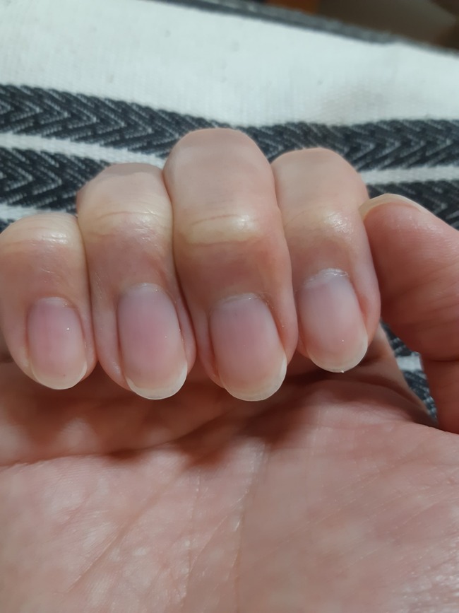 ツイッター民 1年間 爪切りを使わず爪に気遣ってみた ﾊﾟｼｬｯ 超綺麗すぎると話題にｗｗｗｗｗｗ オレ的ゲーム速報 刃