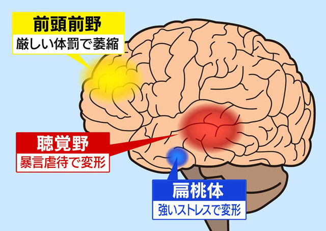 イジメは 脳に傷を与える傷害行為 イラストで見るめちゃくちゃ怖い いじめ後遺症 とは オレ的ゲーム速報 刃