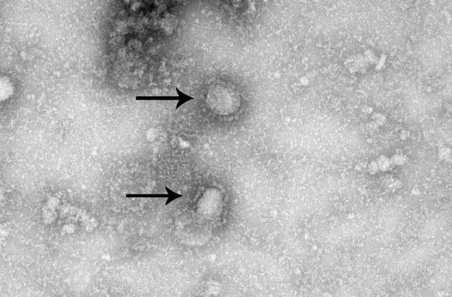 コロナウイルス　新型肺炎　感染　ウイルス　分離　国立感染症研究所に関連した画像-01
