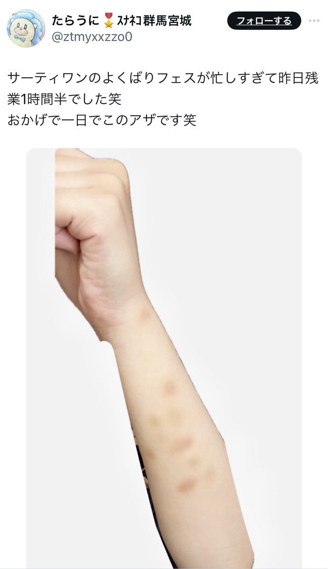 サーティワン 31 よくばりフェス キャンペーン 店員 腱鞘炎 手首 機械 アイスクリームディッシャーに関連した画像-07