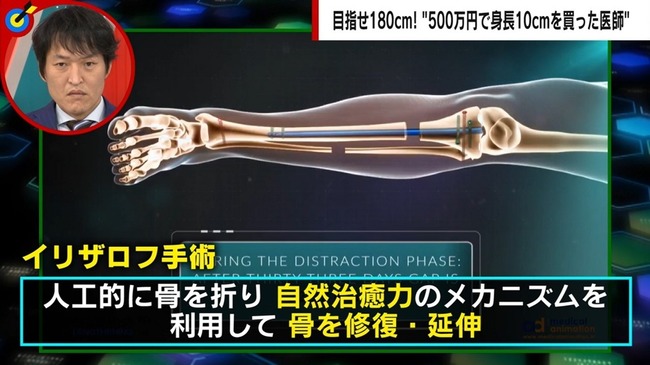 ¿ÈĹ À°·Á³°²Ê°å ÂÀ¤â¤â ¥¹¥Í ¹â¿ÈĹ 500Ëü¤Ë´ØÏ¢¤·¤¿²èÁü-03