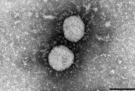 地獄 親子3人全員が感染 自宅療養中だった家庭で40代母親がそのまま息を引き取る オレ的ゲーム速報 刃
