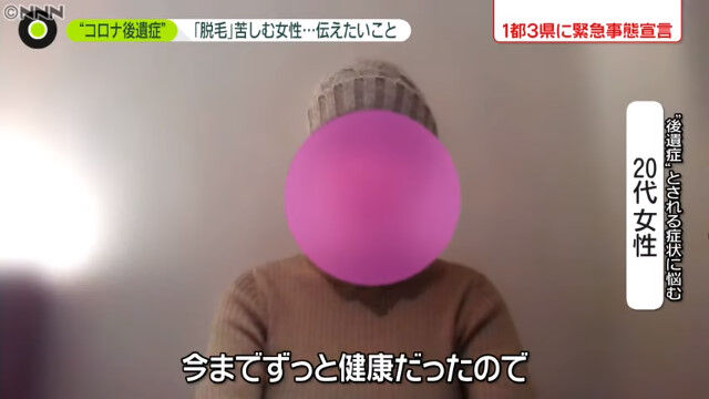 新型コロナ 女子大学院生 後遺症 脱毛 ハゲに関連した画像-02