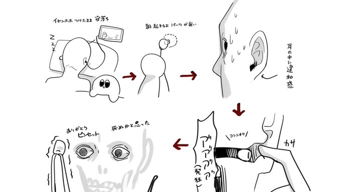 イヤホン 寝たまま 睡眠 中耳炎 耳鼻科 ピンセット イヤーピースに関連した画像-02