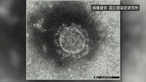 新型コロナウイルス　新型コロナ　ロシア　ワクチン　世界初　接種　開発に関連した画像-01