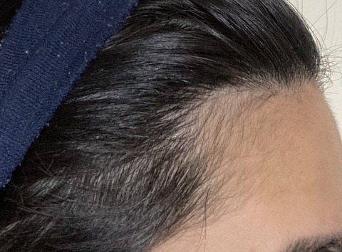 9436B5D2-A72D-48AC-BF92-57C8B40244E9