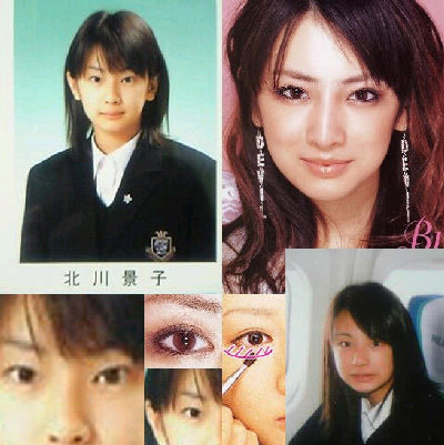 整形画像 別れてもお騒がせｶｯﾌﾟﾙ 北川景子は慶応ボーイの俳優 向井理はアッキーナと 美容外科医ジョニー