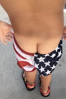 mooning_sunburn01