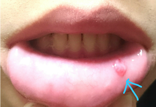 sketch-1523422393868