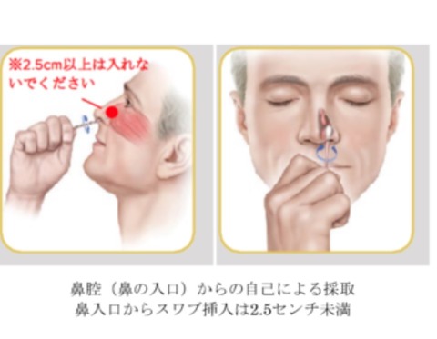 PCR鼻腔頭1