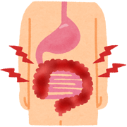 潰瘍性大腸炎