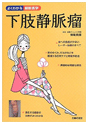 下肢静脈瘤