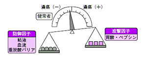 バランス説