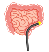 大腸内視鏡検査