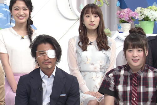 山口達也が眼帯をつけてテレビに出ていた本当の理由が恐ろしかった ジャニ Com じゃにこむ 山口達也が眼帯をつけてテレビに出ていた本当の理由が恐ろしかった ジャニ Com じゃにこむ