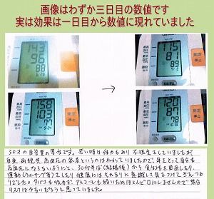 福辻式 高血圧ｄｖｄ 評判レビュー ネタバレ動画