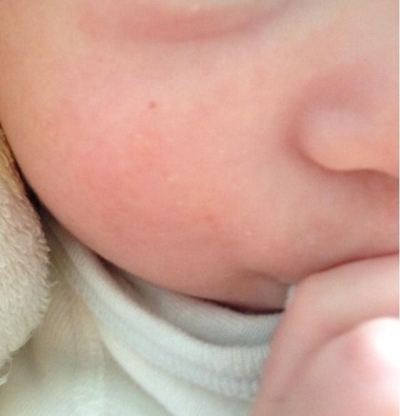 ほくろ snow ほくろ snow