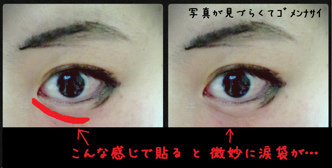 涙袋