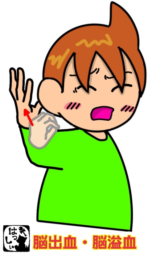 手話単語：1756 【脳出血】【脳溢血】 : 手話しゅわ