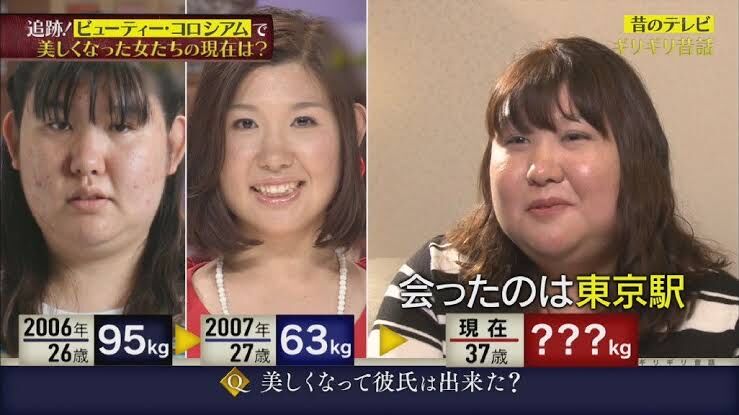 画像 整形を繰り返しまくった女性が話題に Nanjpost なんjまとめ 画像 整形を繰り返しまくった女性が話題に Nanjpost なんjまとめ