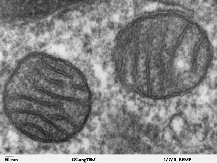 Mitochondria,_mammalian_lung_-_TEM