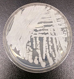 Candida-auris_2016-250px