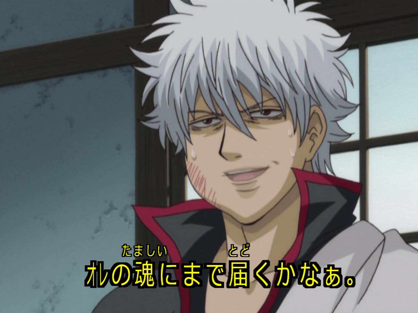 銀魂 175話 幾つになっても歯医者は嫌 海外の感想 かいがいの