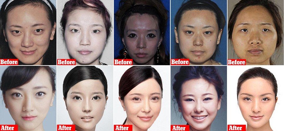 西洋人の顔を手に入れる為に韓国で整形手術をした中国人女性たちのビフォーアフター 海外の反応 海外のお前ら 海外の反応