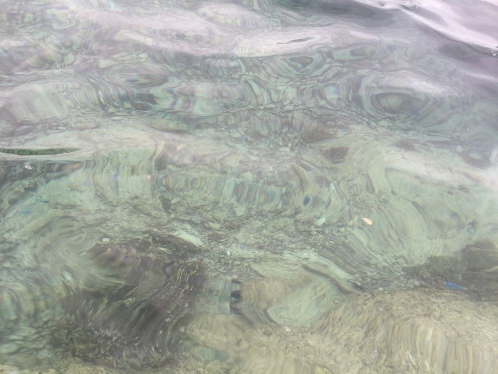 「義肢に痛覚を与える」という奇妙な研究は、わたしたちに何をもたらすか？ ライブドアニュース