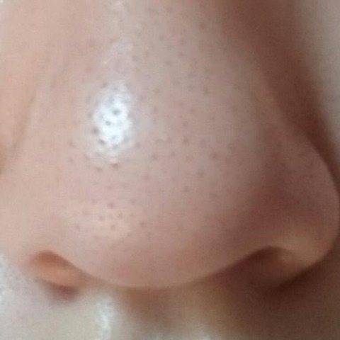 男性のいちご鼻を徹底分析 毛穴のブツブツが気になる方へ改善法 対処法 男が美顔器使って何が悪い