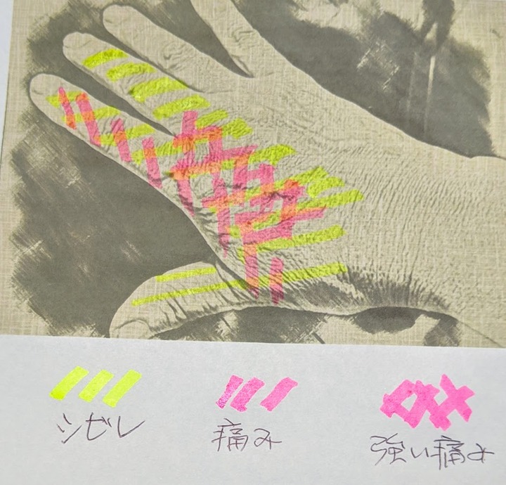 1113状態