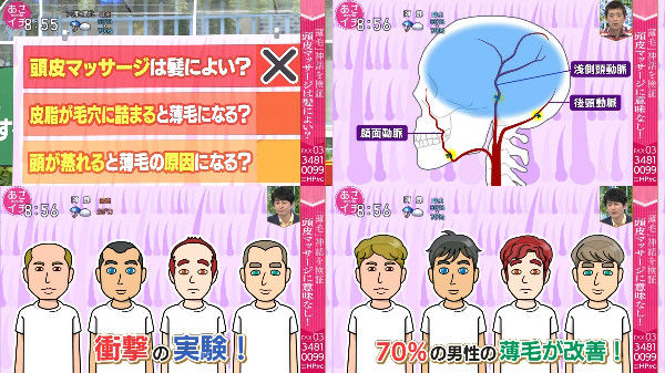 悲報 ハゲたら終わりや ハゲを隠す為の帽子がさらにハゲを進行させると発表される シロクマニュースまとめ