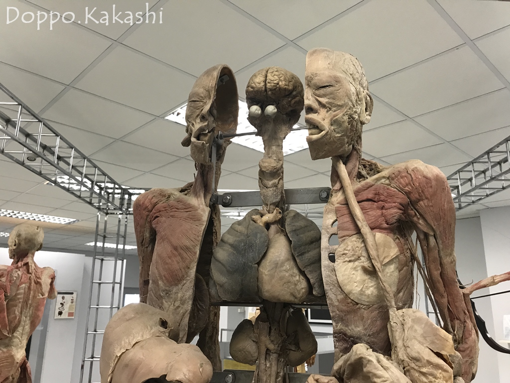 リアルな死体のミニ博物館 Museum Of Human Body チュラロンコン大学 かかし バンコク独歩 バンコク半径2時間の旅 リアルな死体のミニ博物館 Museum Of Human Body チュラロンコン大学 かかし バンコク独歩 バンコク半径2時間の旅