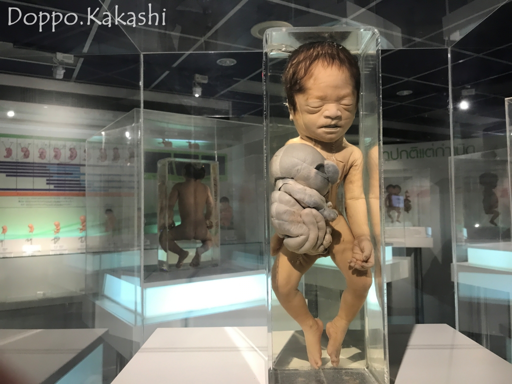 これは強烈 死体博物館 シリラート博物館 シリラート かかし バンコク独歩 バンコク半径2時間の旅