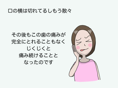 口の横は切れているし、3日ほど気が狂うかと思うほどの痛みに苦しみもう散々 その後も痛みが完全にとれることもなくじくじくと痛み続けることになったのです