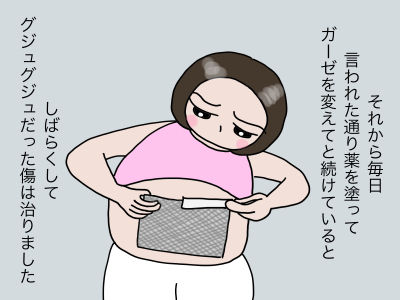 それから毎日、言われた通り薬を塗って、ガーゼを変えてと続けているとしばらくしてグジュグジュだった傷は治りました。