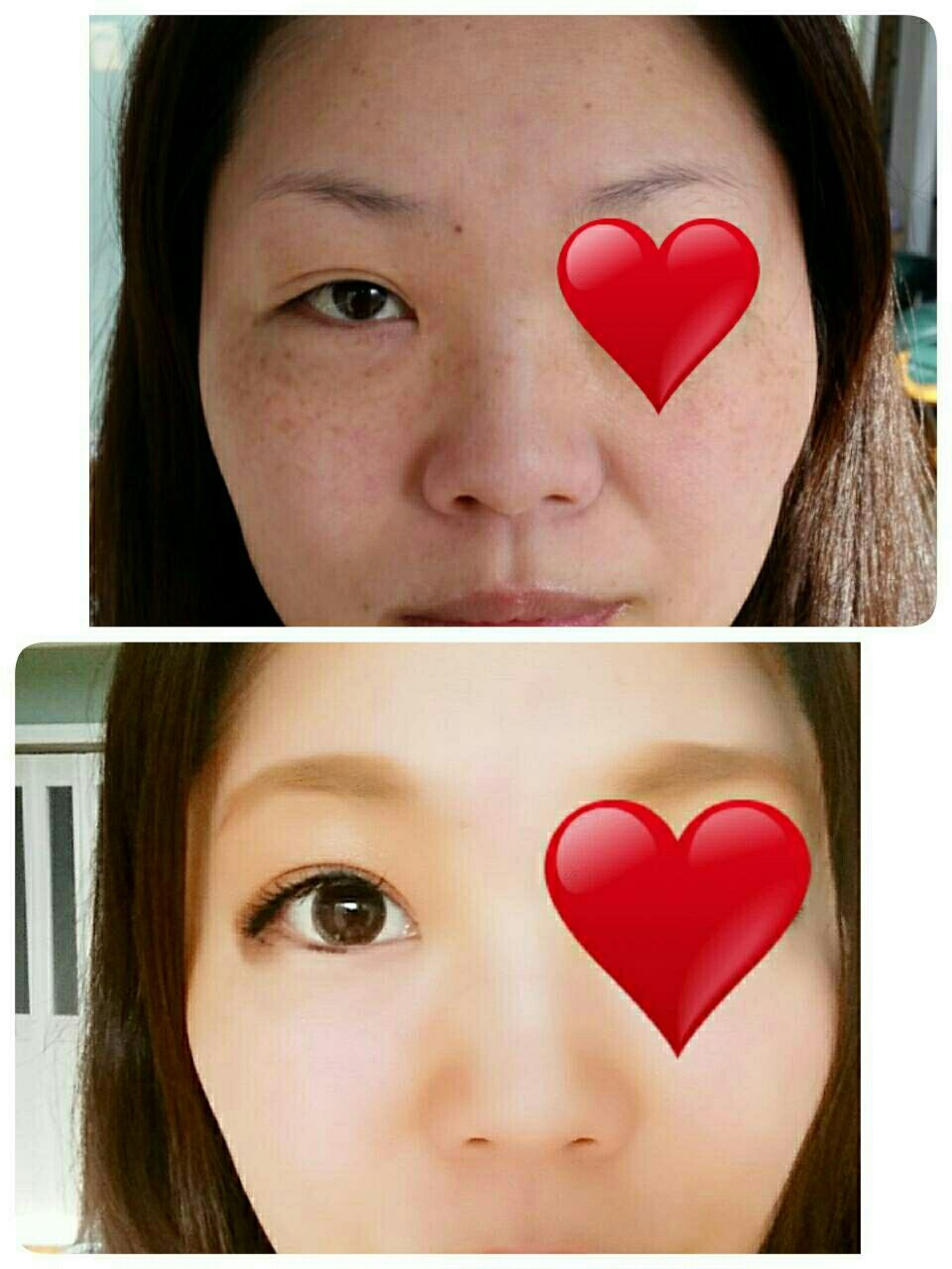 メイクで好きな顔になる 手湿疹 脱ステロイド そして角質培養