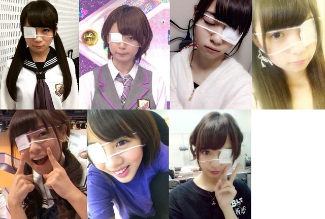 乃木坂46 親知らず抜いたら幼い感じで可愛いよなwwwww 画像 透明な上り坂 乃木坂46まとめ 乃木坂46 親知らず抜いたら幼い感じで可愛いよなwwwww 画像 透明な上り坂 乃木坂46まとめ