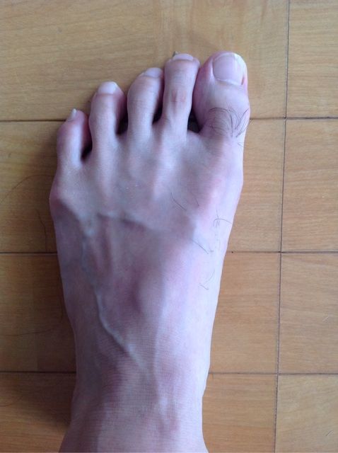 足の甲の鈍痛に効くテーピング 私の場合 Kamehinaoのお気楽日記３
