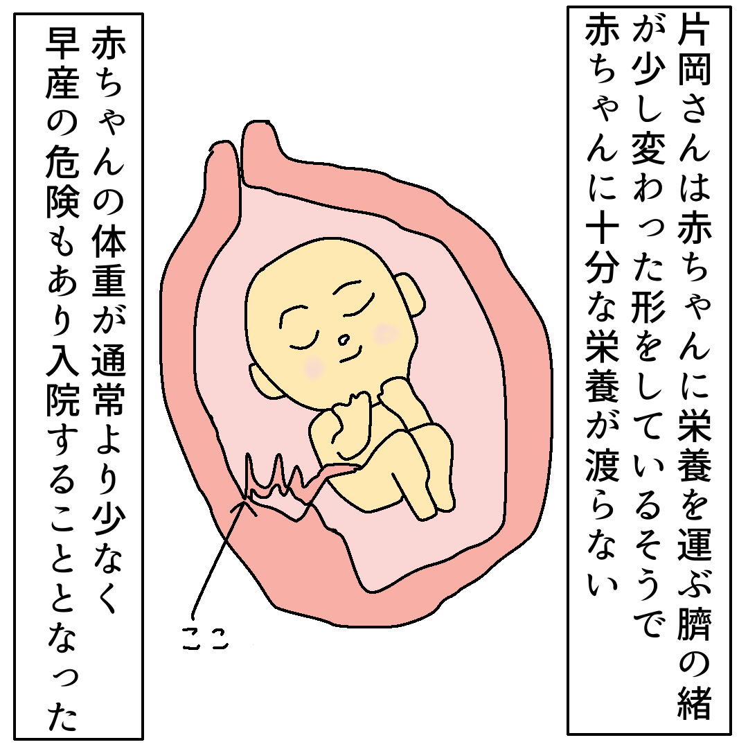 切迫早産 入院ライフ⑤ : かめまるワールド