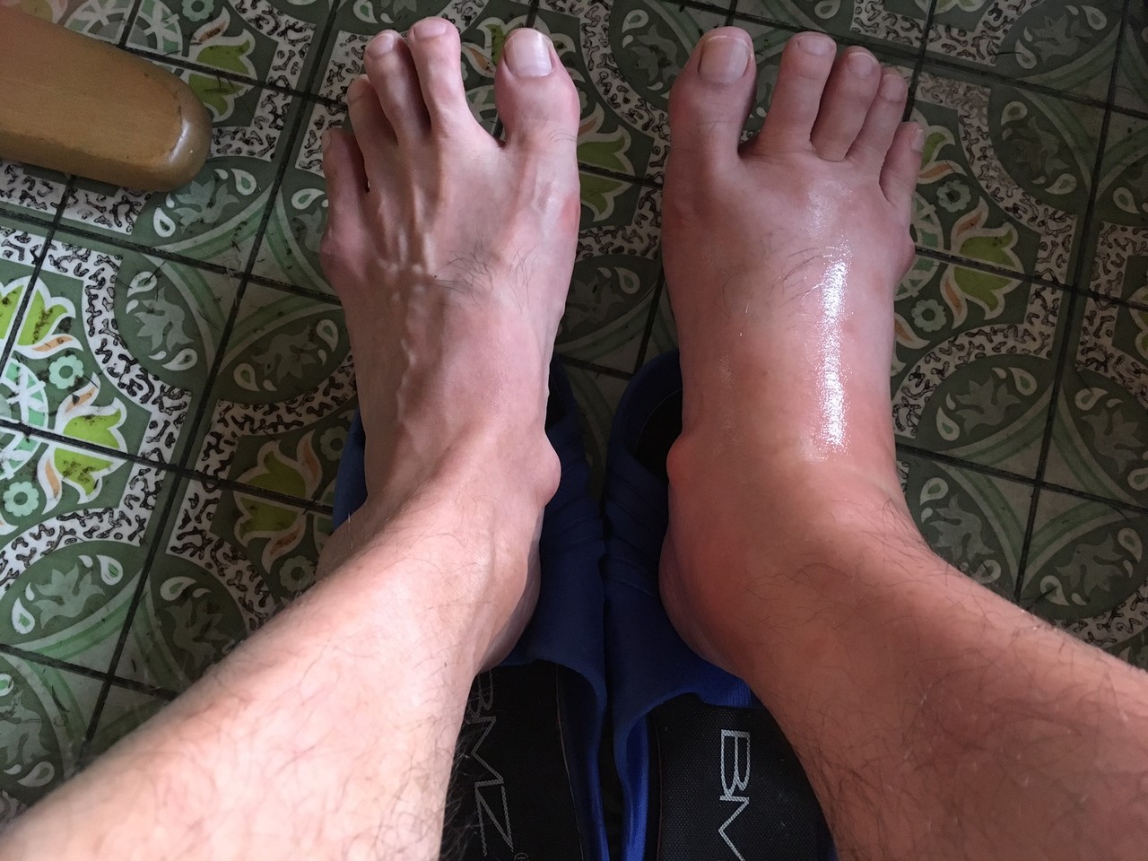 足パンパン 亀の スキー馬鹿一代記